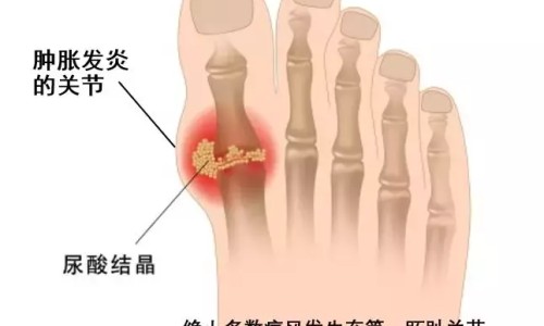 糖料病人中餐要用药吗多少钱-糖料病人能吃的糖有哪些-糖料病人的血糖控制在什么范围,中国糖料病人中餐要用药吗网站
